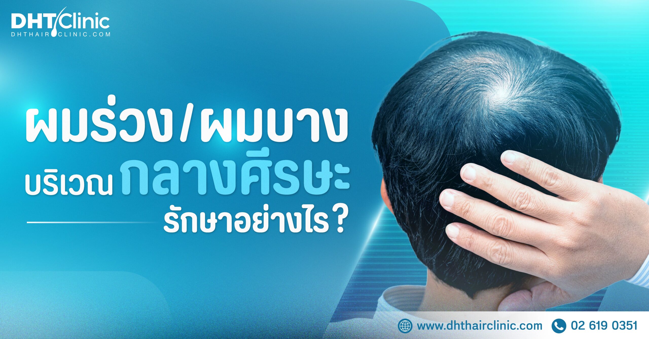 ผมร่วง/ผมบางกลางศีรษะ รักษาอย่างไร ?